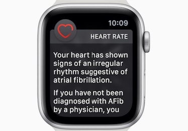 Apple Watch fib notification 