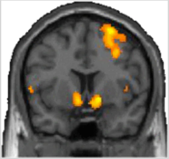 Neuroscience Reveals How The Brain Changes As It Watches Porn neuroscience-reveals-how-the-brain-changes-as-it-watches-porn