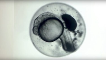 zebrafish embryo 