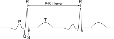 R-R interval