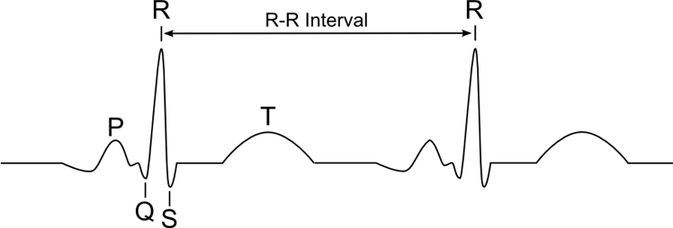 R-R interval