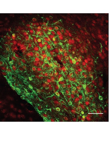 Cells in the brain's central amygdala in red and green
