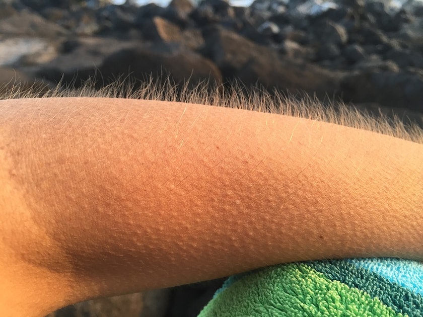 Voluntary Piloerection: People Can Control Their Own Goosebumps