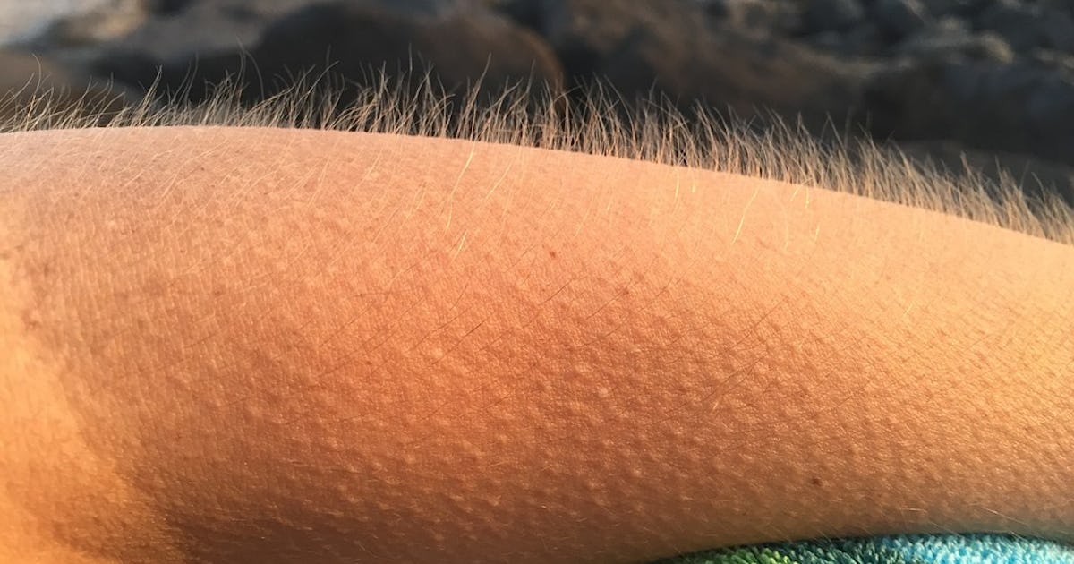 Voluntary Piloerection People Can Control Their Own Goosebumps Voluntary Piloerection People Can Control Their Own Goosebumps