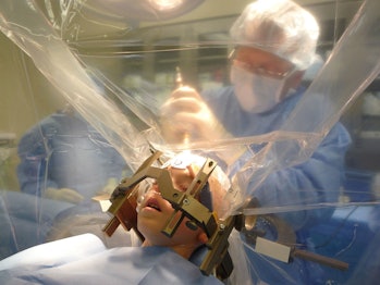 DBS deep brain stimulation stimulus surgery head probe electrode child