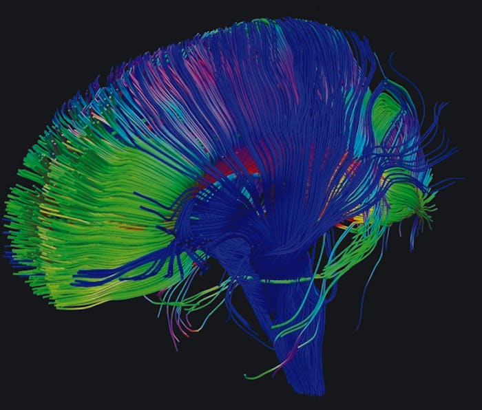 Scientists developed a better way to monitor brain activity