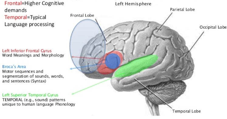 Language areas of the brain.