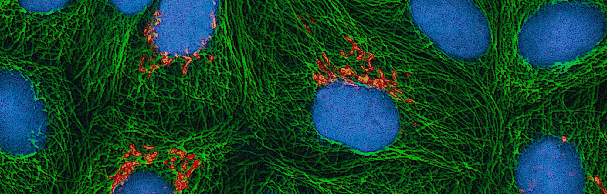 The Real Science Of Henrietta Lacks S Immortal Cells The Real Science Of Henrietta Lacks S Immortal Cells