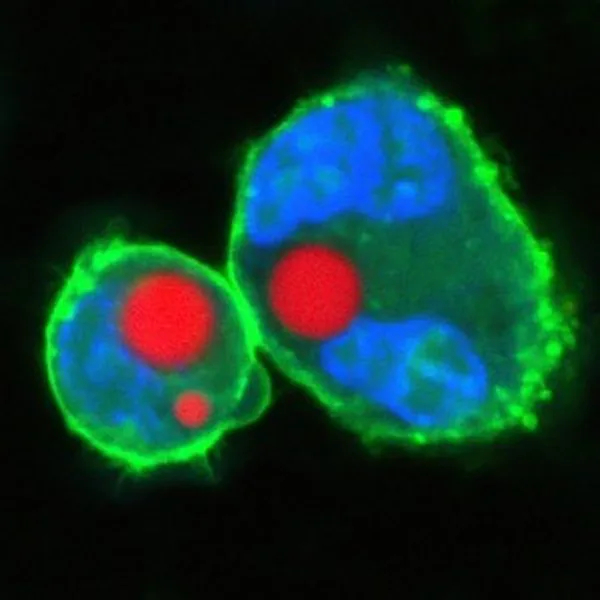 How to Give Cells Their Own Microscopic Lasers