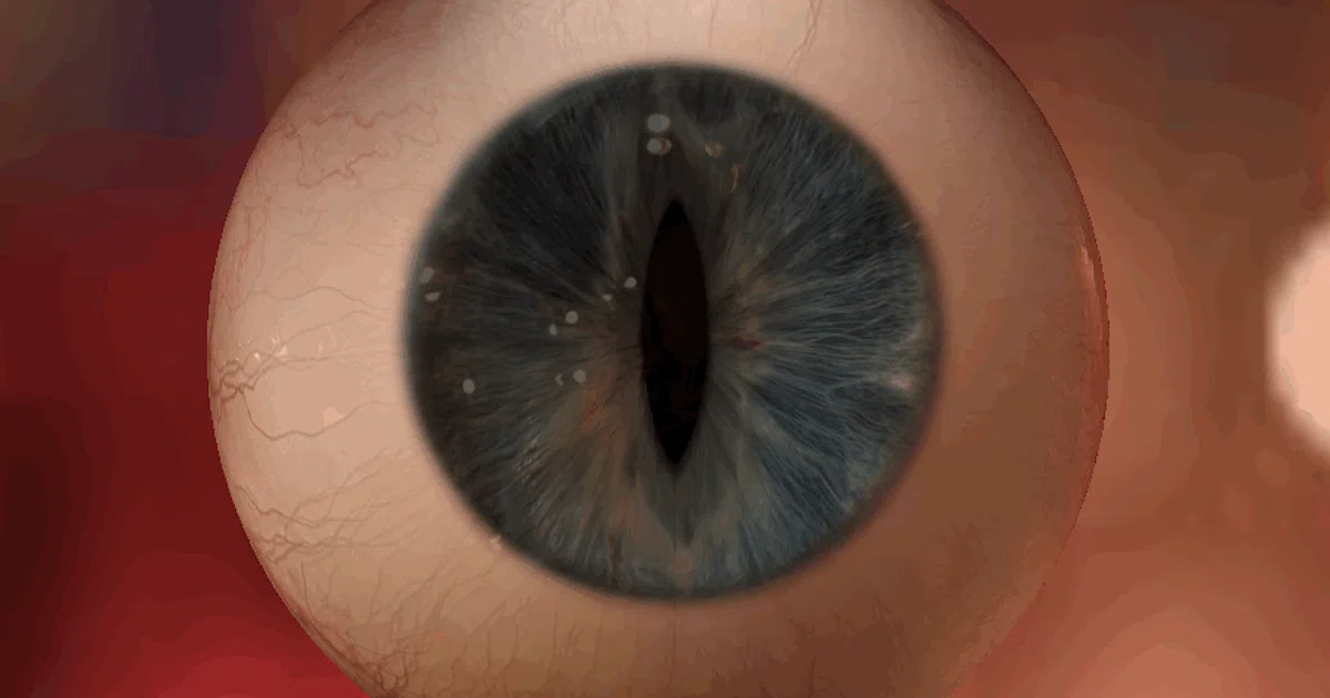 Pupils Dilated Gif