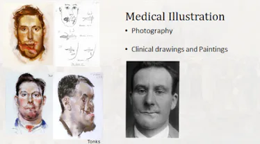 How WWI Injuries Led to a $16 Billion Plastic Surgery Industry