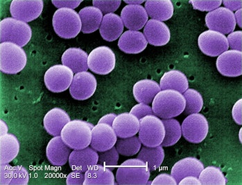 Staphylococcus aureus VISA 2