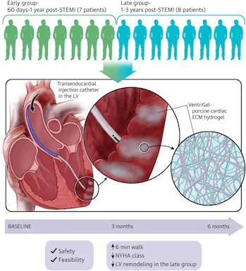 Injectable Pig Heart Tissue Is the Future of Recovering From ...