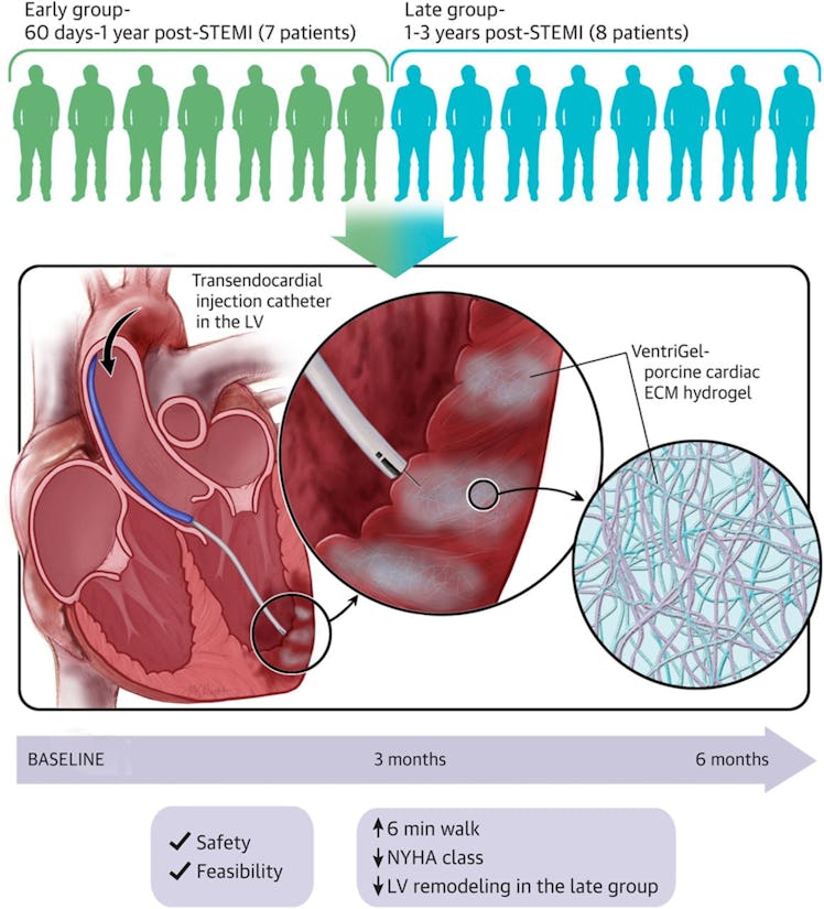 graphic abstract for pig cardiac cell therapy