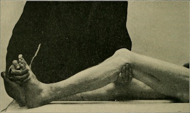 Image from page 317 of "A practical treatise on medical diagnosis for students and physicians" (1904...
