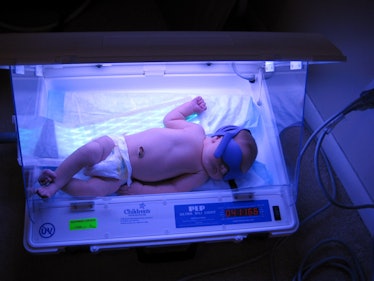 jaundice baby light therapy premature