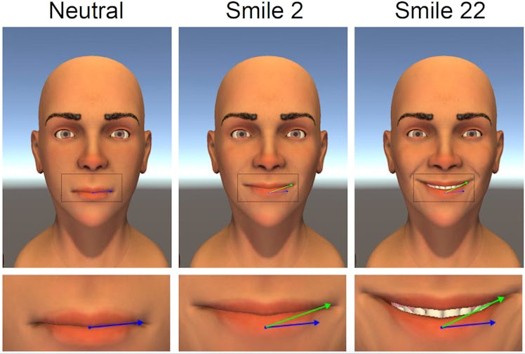 optimal mouth smile symmetry perfect smile rehabilitation simulation 3D animation
