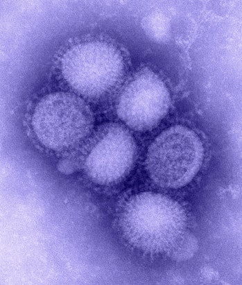 The H1N1 influenza virus. 