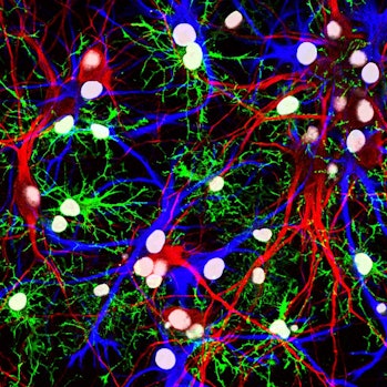 Neurons & glia