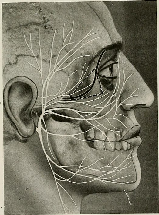 Image from page 160 of "Surgical treatment; a practical treatise on the therapy of surgical diseases...
