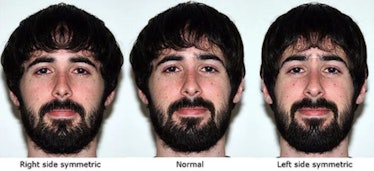 facial symmetry 