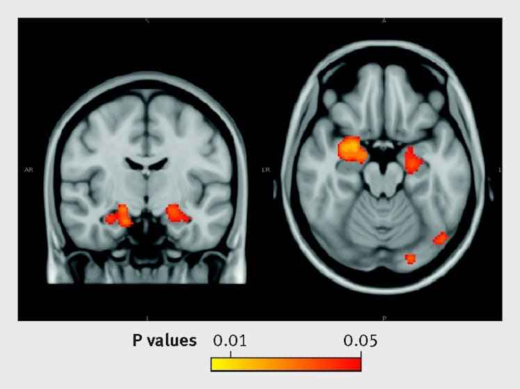 fMRI moderate alcohol