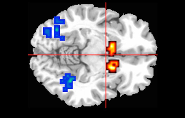 brain on CBD