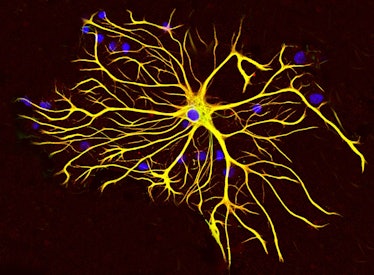 Astrocytes, a type of brain cell. The nuclei of individual cells are stained blue, and structural fi...