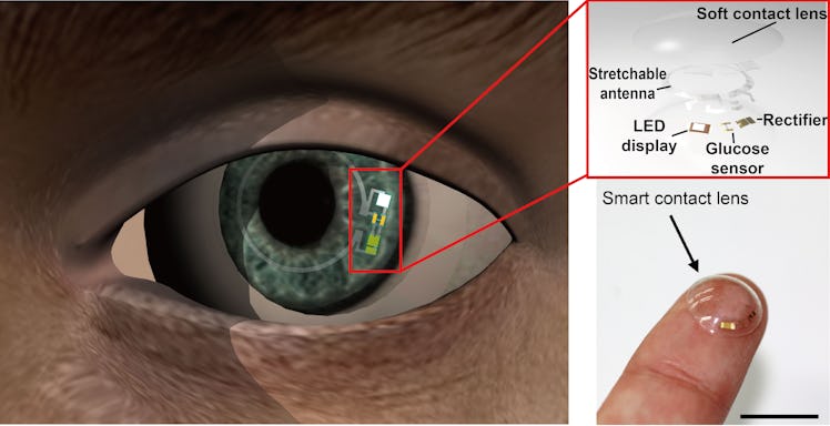 contact lens engineering