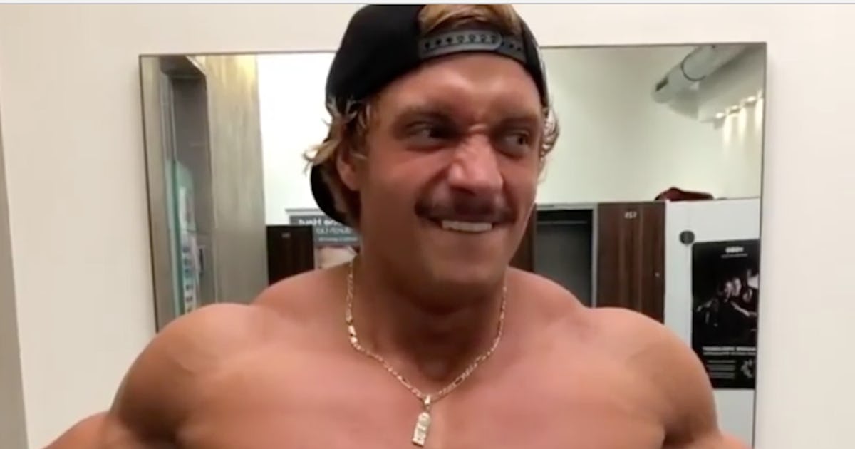 Reddit Video Shows Effects of Rippling Muscle Disease on 'Alien Gains'