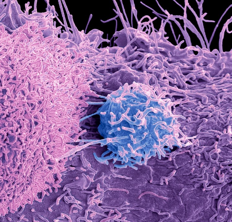 prostate cancer cell