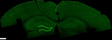 rat brain hippocampus TI temporal temporally interference stimulation neuroscience