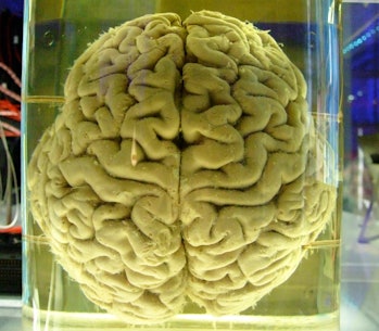 A real-life human brain, not Sally from 'Pacific Rim Uprising'.