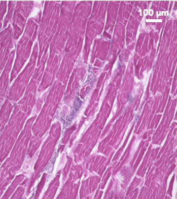 skeletal muscle tissue of meat