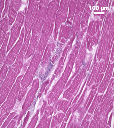 skeletal muscle tissue of meat