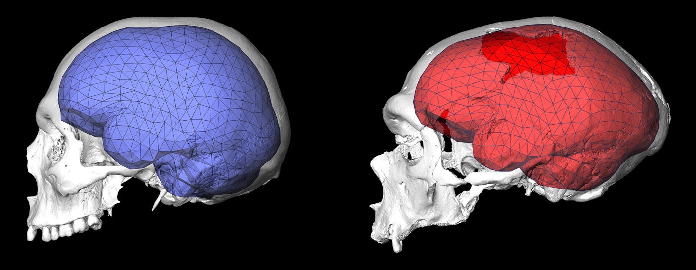 Brain Shape Evolution Coincided With the Birth of Modern Behavior