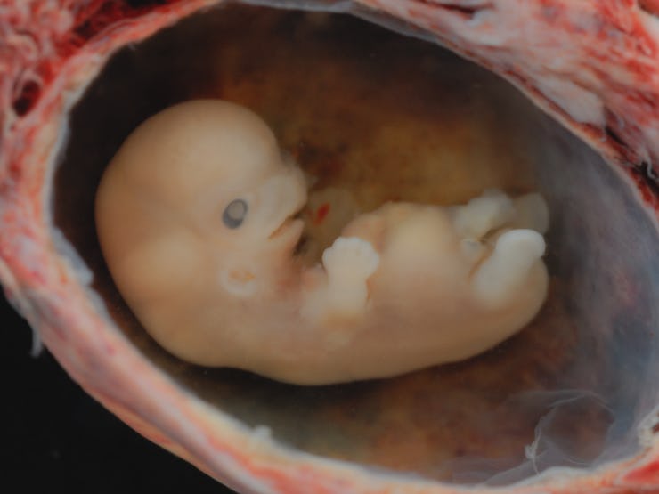 A closeup of an embryo