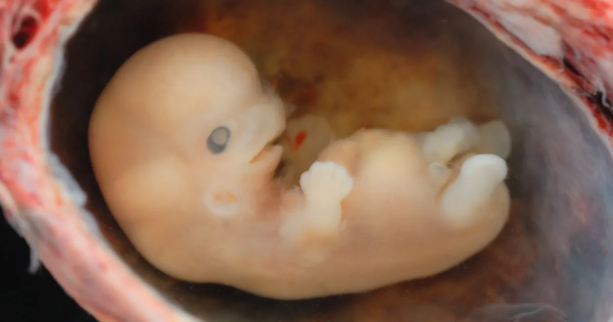 U S Laws On Human Embryo Gene Editing Are Unexpectedly Lax U S Laws On Human Embryo Gene Editing Are Unexpectedly Lax