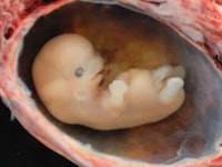 A closeup of an embryo