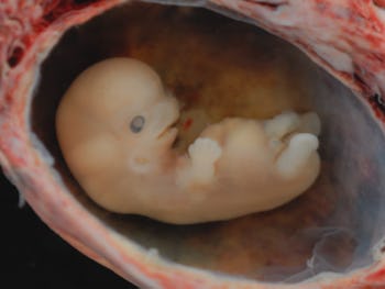 A closeup of an embryo