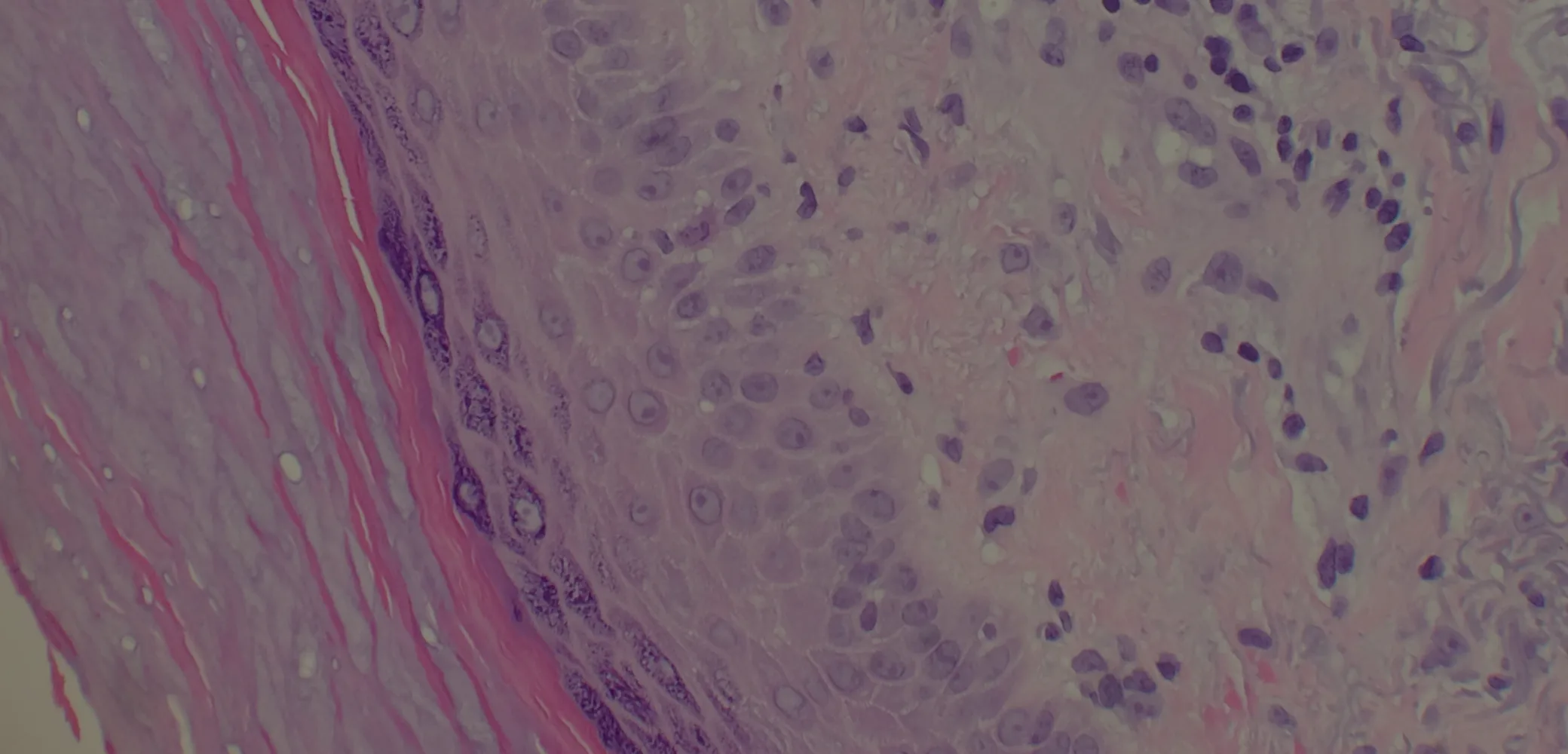 Interillum Interstitium: A Guide to the