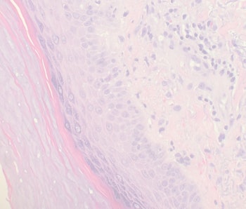 Interstitium: A Guide to the \