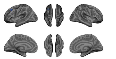 cortical thickness exercise brain