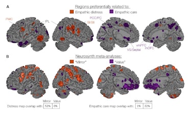 brain neuroscience map MRI fMRI empathy empathic care distress