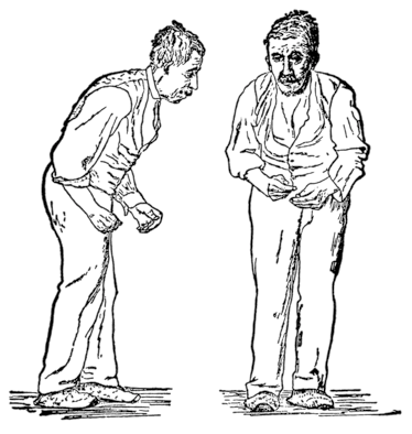Gowers Parkinson illustration of two men walking