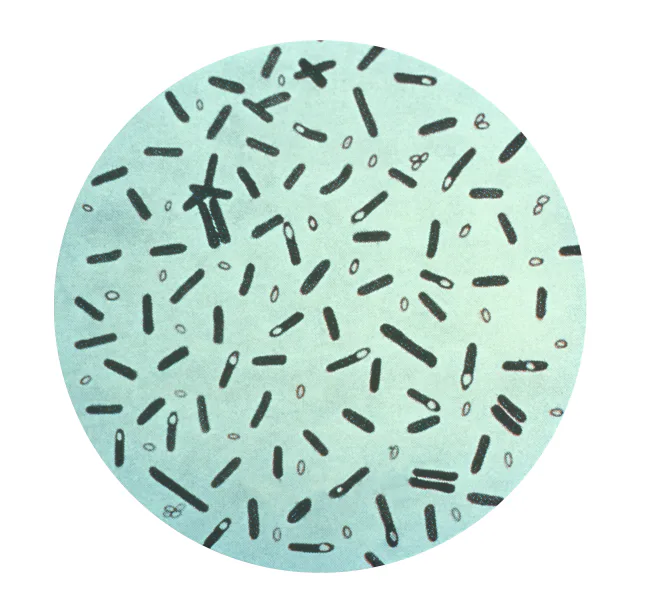 What Is Botulism, and How Can You Prevent It?