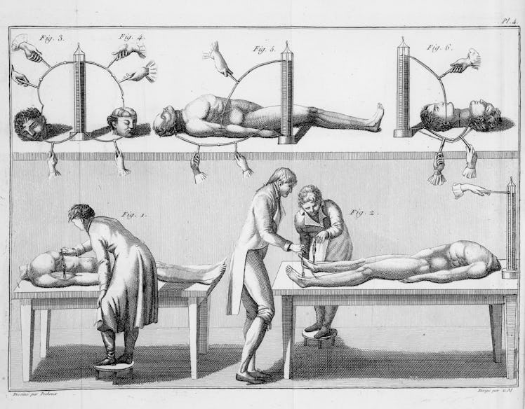 Giovanni Aldini’s experiments with a human corpse.