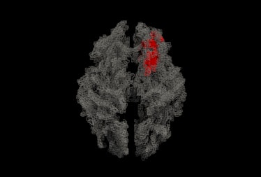 magnetic resonance imaging of a brain