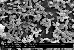 Switching Cells On and Off With Electricity to Detect Disease