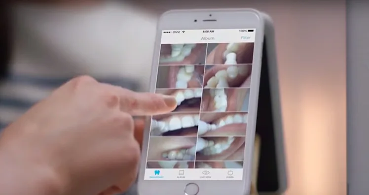 Toothbrush Scroll Smart-Video Toothbrush Prophix Recommends Better Techniques